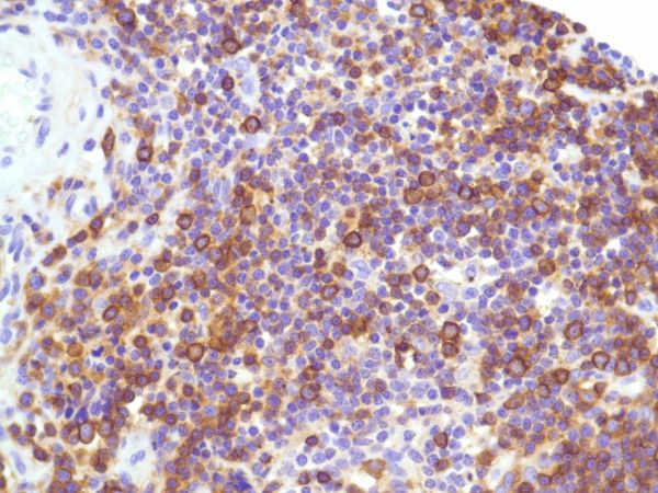 Immunohistochemistry (Formalin/PFA-fixed paraffin-embedded sections) - Anti-CD99 antibody [SP119] - BSA and Azide free (ab240990), expandable thumbnail