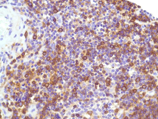 Immunohistochemistry (Formalin/PFA-fixed paraffin-embedded sections) - Anti-CD99 antibody [SP119] - BSA and Azide free (AB240990)