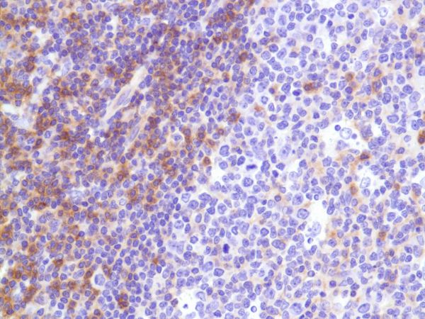 Immunohistochemistry (Formalin/PFA-fixed paraffin-embedded sections) - Anti-CD99 antibody [SP119] - BSA and Azide free (AB240990), expandable thumbnail