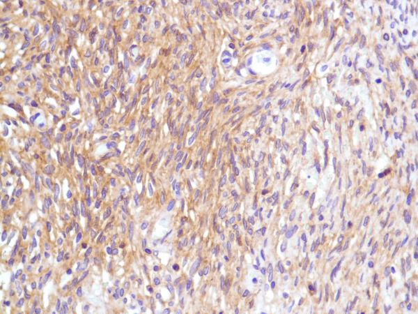 Immunohistochemistry (Formalin/PFA-fixed paraffin-embedded sections) - Anti-CD99 antibody [SP119] - BSA and Azide free (AB240990), expandable thumbnail