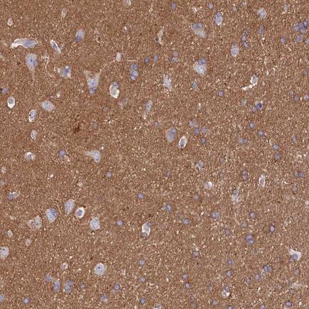 Immunohistochemistry (Formalin/PFA-fixed paraffin-embedded sections) - Anti-CD99L2 antibody (AB224164), expandable thumbnail