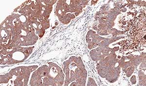 Immunohistochemistry (Formalin/PFA-fixed paraffin-embedded sections) - Anti-CDA antibody (AB137605)