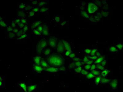 Immunocytochemistry/ Immunofluorescence - Anti-CDA antibody (AB231981)