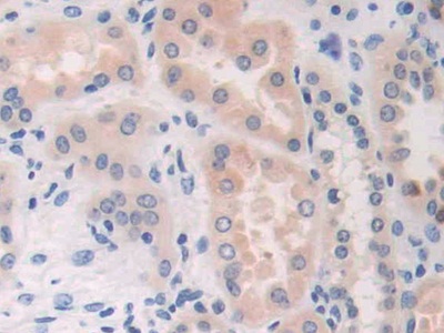 Immunohistochemistry (Formalin/PFA-fixed paraffin-embedded sections) - Anti-CDA antibody (AB231981)