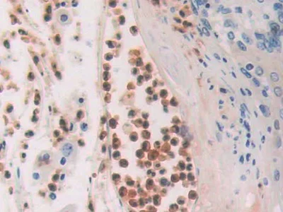 Immunohistochemistry (Formalin/PFA-fixed paraffin-embedded sections) - Anti-CDA antibody (AB231981)