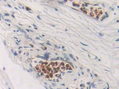 Immunohistochemistry (Formalin/PFA-fixed paraffin-embedded sections) - Anti-CDA antibody (AB231981)