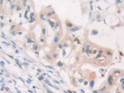 Immunohistochemistry (Formalin/PFA-fixed paraffin-embedded sections) - Anti-CDA antibody (AB231981)