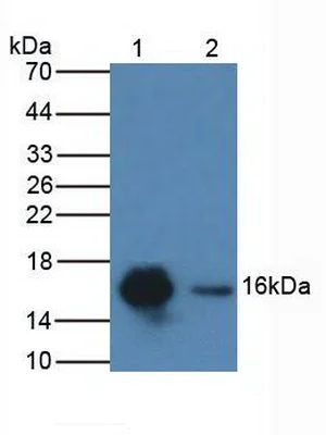 Western blot - Anti-CDA antibody (AB231981)