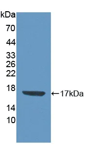 Western blot - Anti-CDA antibody (AB231981)