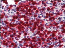 Immunohistochemistry (Formalin/PFA-fixed paraffin-embedded sections) - Anti-CDA antibody (AB78231), expandable thumbnail