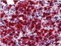 Immunohistochemistry (Formalin/PFA-fixed paraffin-embedded sections) - Anti-CDA antibody (AB78231)