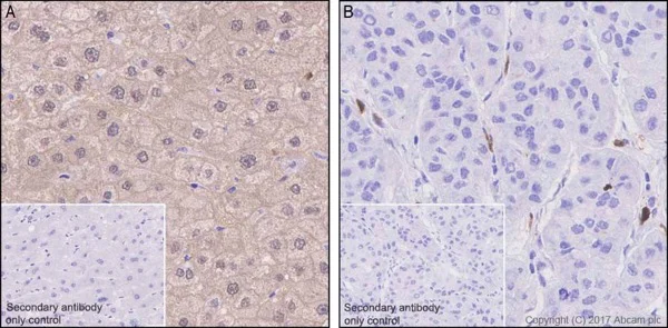 Immunohistochemistry (Formalin/PFA-fixed paraffin-embedded sections) - Anti-CDA antibody [EPR20525] (AB222515)