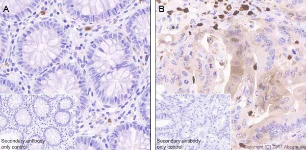 Immunohistochemistry (Formalin/PFA-fixed paraffin-embedded sections) - Anti-CDA antibody [EPR20525] (AB222515)
