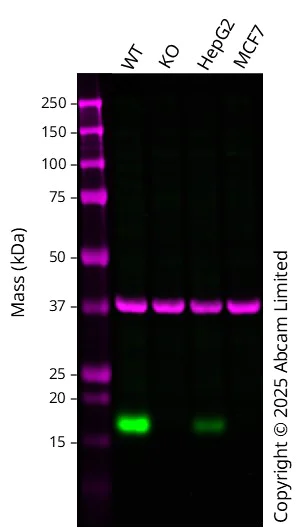 Western blot - Anti-CDA antibody [EPR20525] (AB222515)