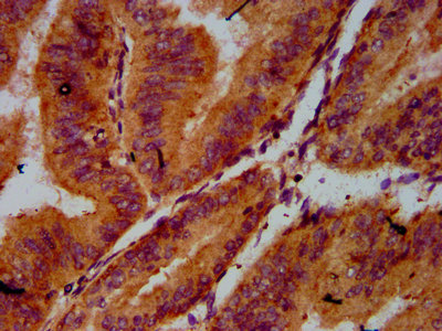 Immunohistochemistry (Formalin/PFA-fixed paraffin-embedded sections) - Anti-CDC123 antibody (AB238560)