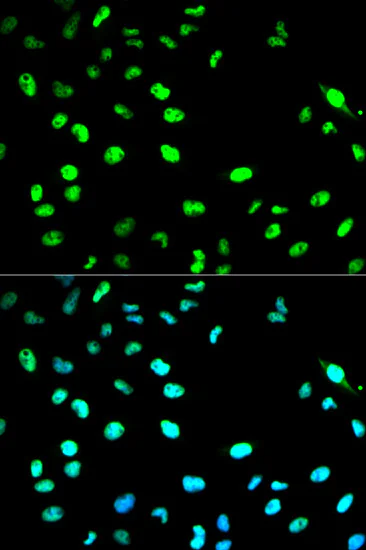 Immunocytochemistry/ Immunofluorescence - Anti-Cdc20 antibody (AB185814)