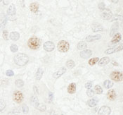 Immunohistochemistry (Formalin/PFA-fixed paraffin-embedded sections) - Anti-Cdc20 antibody (AB86104), expandable thumbnail