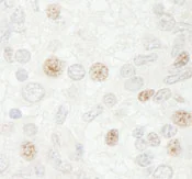 Immunohistochemistry (Formalin/PFA-fixed paraffin-embedded sections) - Anti-Cdc20 antibody (AB86104)