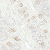Immunohistochemistry (Formalin/PFA-fixed paraffin-embedded sections) - Anti-Cdc20 antibody (AB86104), expandable thumbnail