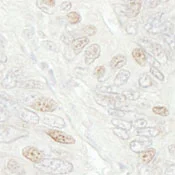 Immunohistochemistry (Formalin/PFA-fixed paraffin-embedded sections) - Anti-Cdc20 antibody (AB86104)