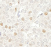 Immunohistochemistry (Formalin/PFA-fixed paraffin-embedded sections) - Anti-Cdc20 antibody (AB86104), expandable thumbnail