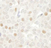 Immunohistochemistry (Formalin/PFA-fixed paraffin-embedded sections) - Anti-Cdc20 antibody (AB86104)