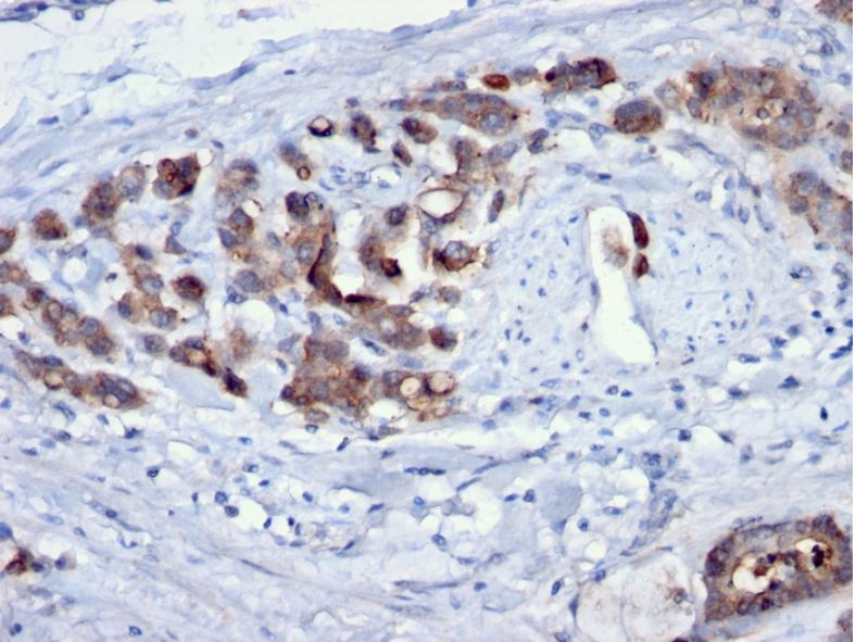Immunohistochemistry (Formalin/PFA-fixed paraffin-embedded sections) - Anti-Cdc20 antibody [AR12] (AB190711)