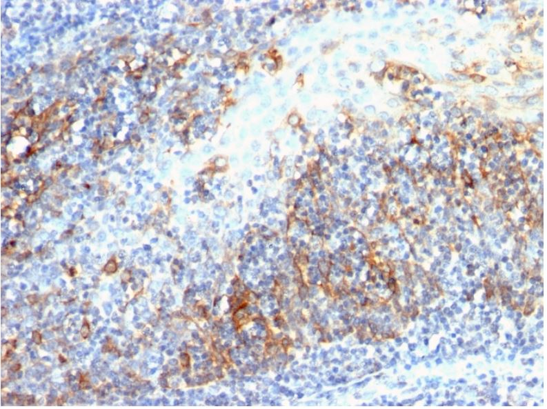 Immunohistochemistry (Formalin/PFA-fixed paraffin-embedded sections) - Anti-Cdc20 antibody [AR12] (AB190711)