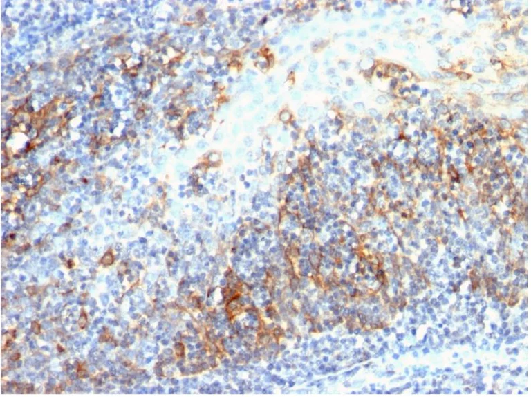 Immunohistochemistry (Formalin/PFA-fixed paraffin-embedded sections) - Anti-Cdc20 antibody [AR12] (AB190711)