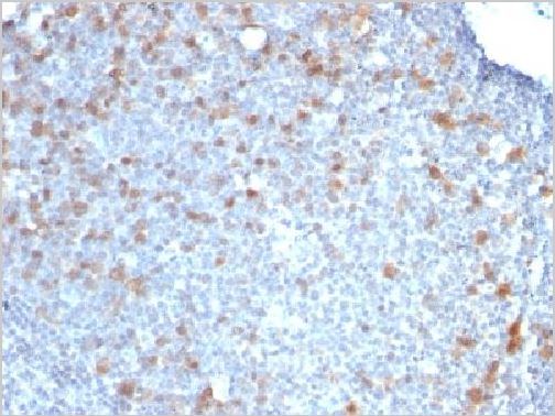 Immunohistochemistry (Formalin/PFA-fixed paraffin-embedded sections) - Anti-Cdc20 antibody [CDC20/1102] (AB215908), expandable thumbnail