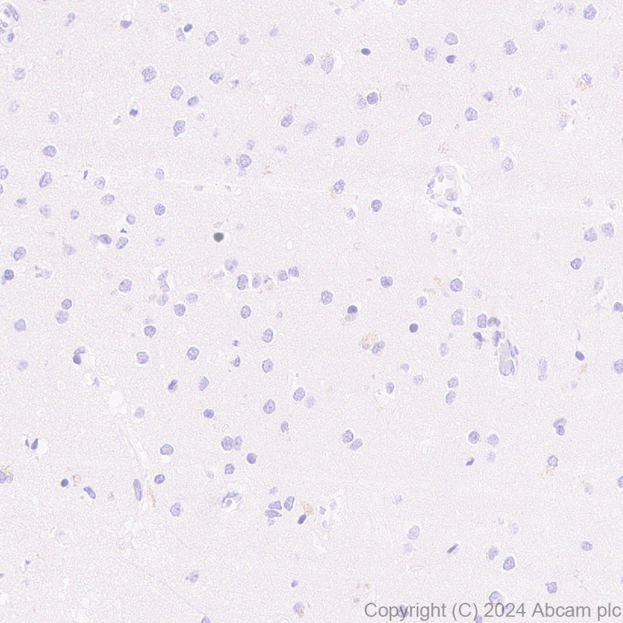 Immunohistochemistry (Formalin/PFA-fixed paraffin-embedded sections) - Anti-Cdc20 antibody [EPR28091-55] (AB317036)
