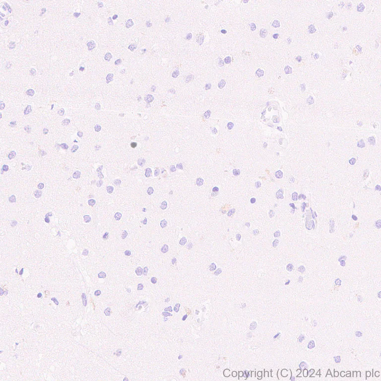 Immunohistochemistry (Formalin/PFA-fixed paraffin-embedded sections) - Anti-Cdc20 antibody [EPR28091-55] - BSA and Azide free (AB317037)