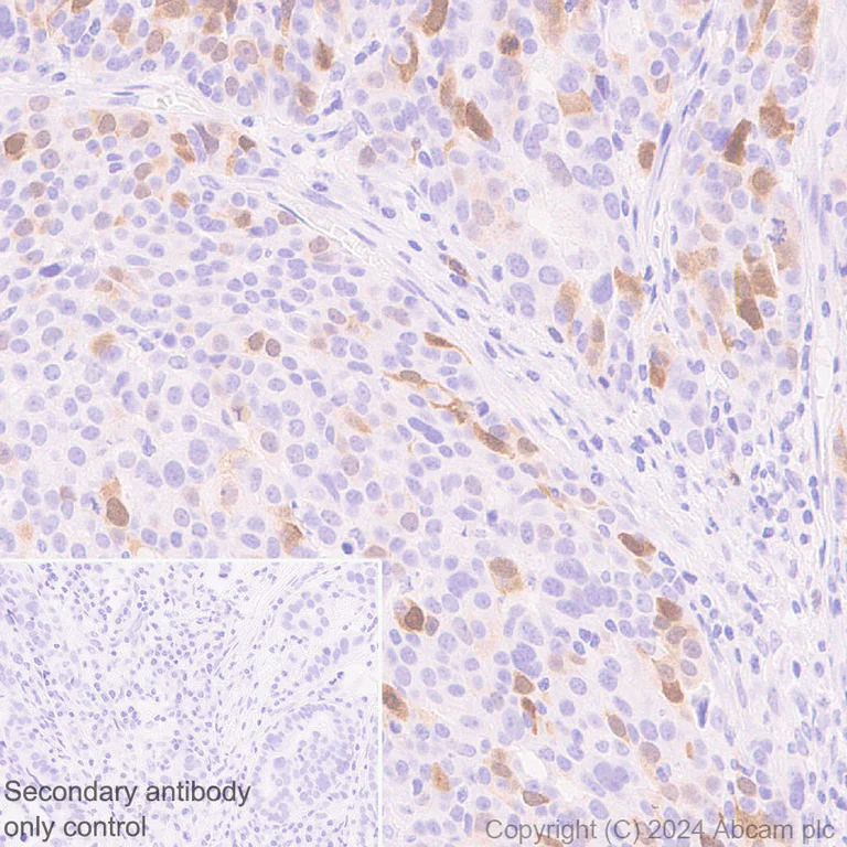 Immunohistochemistry (Formalin/PFA-fixed paraffin-embedded sections) - Anti-Cdc20 antibody [EPR28091-55] - BSA and Azide free (AB317037)