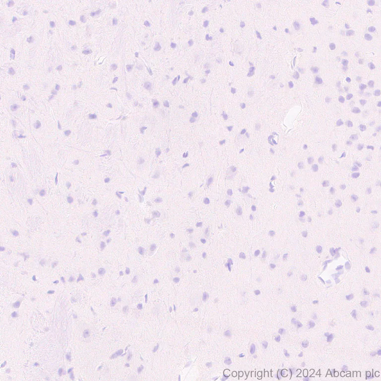 Immunohistochemistry (Formalin/PFA-fixed paraffin-embedded sections) - Anti-Cdc20 antibody [EPR28091-55] - BSA and Azide free (AB317037)