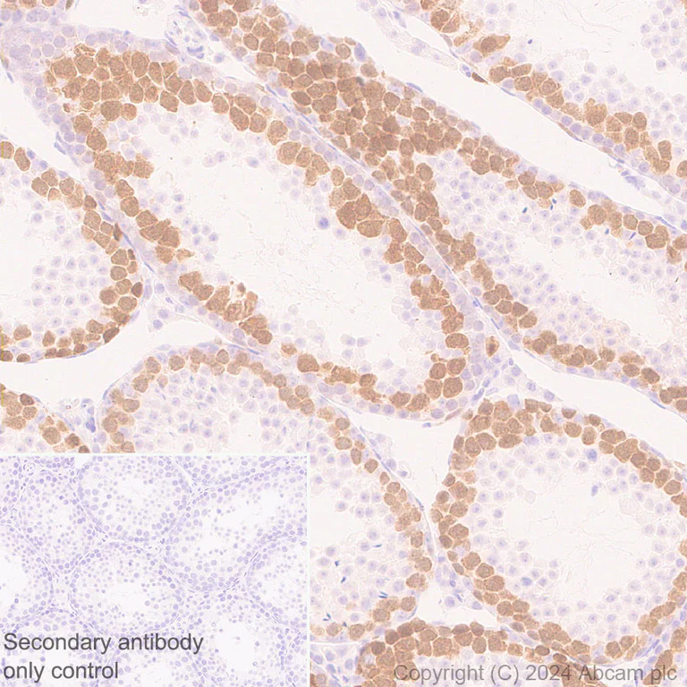 Immunohistochemistry (Formalin/PFA-fixed paraffin-embedded sections) - Anti-Cdc20 antibody [EPR28091-55] - BSA and Azide free (AB317037)