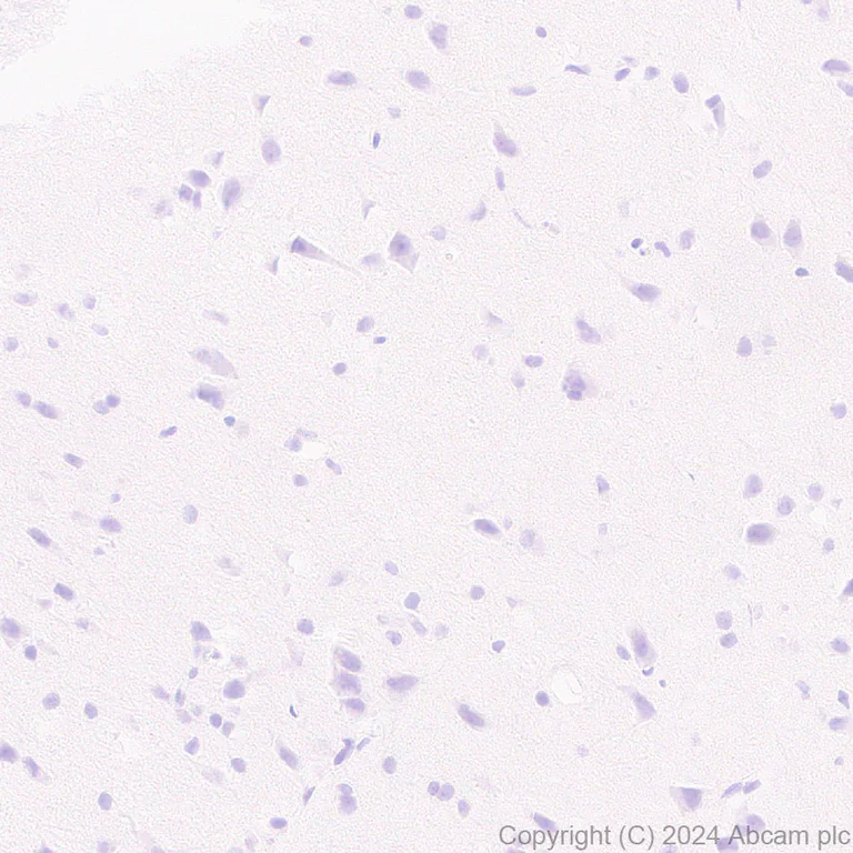 Immunohistochemistry (Formalin/PFA-fixed paraffin-embedded sections) - Anti-Cdc20 antibody [EPR28091-55] - BSA and Azide free (AB317037)