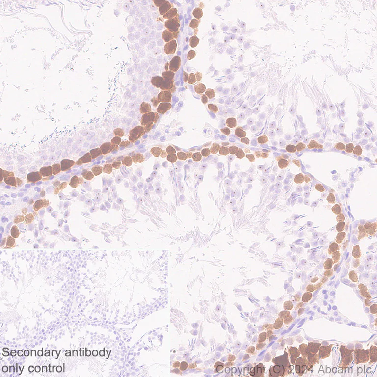 Immunohistochemistry (Formalin/PFA-fixed paraffin-embedded sections) - Anti-Cdc20 antibody [EPR28091-55] - BSA and Azide free (AB317037)
