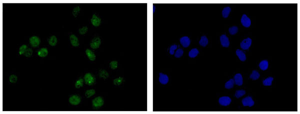 Immunocytochemistry/ Immunofluorescence - Anti-Cdc23 antibody [EPR11828] (AB182003), expandable thumbnail