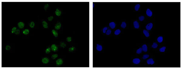 Immunocytochemistry/ Immunofluorescence - Anti-Cdc23 antibody [EPR11828] (AB182003)