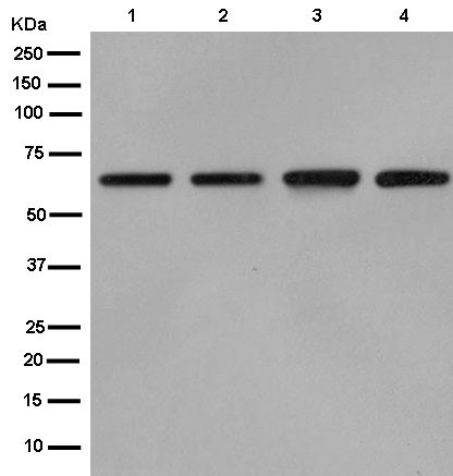 Western blot - Anti-Cdc23 antibody [EPR11828] (AB182003), expandable thumbnail