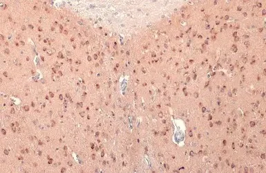 Immunohistochemistry (Formalin/PFA-fixed paraffin-embedded sections) - Anti-CDC25 antibody (AB272920)