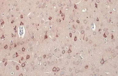 Immunohistochemistry (Formalin/PFA-fixed paraffin-embedded sections) - Anti-CDC25 antibody (AB272920)