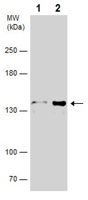 Western blot - Anti-CDC25 antibody (AB272920), expandable thumbnail