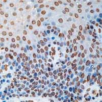 Immunohistochemistry (Formalin/PFA-fixed paraffin-embedded sections) - Anti-Cdc25A antibody [DCS-120 + DCS-121] (AB2357)
