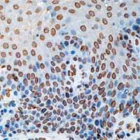 Immunohistochemistry (Formalin/PFA-fixed paraffin-embedded sections) - Anti-Cdc25A antibody [DCS-120 + DCS-121] (AB2357)