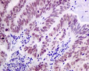 Immunohistochemistry (Formalin/PFA-fixed paraffin-embedded sections) - Anti-Cdc25A (phospho S124) antibody [EPR8888] (AB156574)