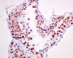 Immunohistochemistry (Formalin/PFA-fixed paraffin-embedded sections) - Anti-Cdc25A (phospho S124) antibody [EPR8888] (AB156574)