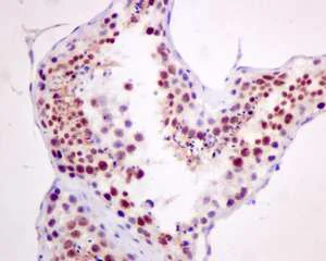 Immunohistochemistry (Formalin/PFA-fixed paraffin-embedded sections) - Anti-Cdc25A (phospho S124) antibody [EPR8888] - BSA and Azide free (AB249269)