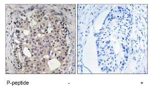 Immunohistochemistry (Formalin/PFA-fixed paraffin-embedded sections) - Anti-Cdc25A (phospho S178) antibody (AB79252)