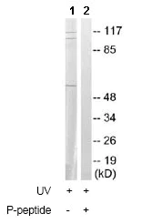 Western blot - Anti-Cdc25A (phospho S178) antibody (AB79252)